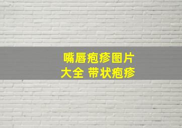 嘴唇疱疹图片大全 带状疱疹